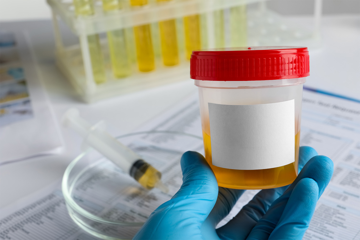 lab technician handling specimen cup with gloves
